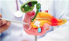 نقطه ضعف سرطان لوزالمعده کشف شد!