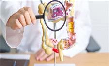 با این آزمایش ساده دیگر نیازی به کولونوسکوپی نیست