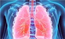 تشخیص زودهنگام آسم با آزمایش نوآورانه دانشگاه آکسفورد