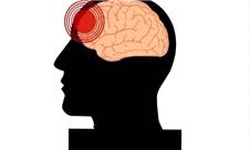 آسیب‌های تروماتیک مغزی در افراد مسن با افزایش خطر زوال عقل مرتبط است