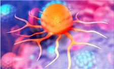 سرطان روده سپر انداخت