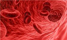 درمان سریع و بی عارضه کم‌خونی فقر آهن با نسل جدید نانو مکمل‌های ایرانی