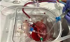 پیوند اولین کلیه هیبریدی انسان-خوک در اسپانیا