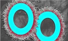 نابودی بیش از 80 درصدی تومورهای تخمدان با نانوذرات جدید