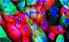 پژوهشی درباره رشد طبیعی یک آنزیم تا شکل‌گیری تومور از آن/ «کینازها» شمشیر دولبه در بدن انسان