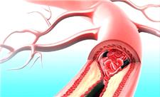 دارویی که همزمان با بیماری قلبی و دیابت مقابله می‌کند