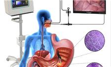 ساخت دستگاه تشخیص دقیق سرطان‌های دستگاه گوارش فوقانی