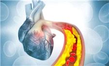 کاهش چربی خون با کمک ویرایش ژن برای اولین بار