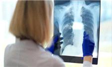 یک مشکل پنهان تنفسی ممکن است دلیل خستگی مزمن باشد