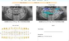 توسعه سامانه هوشمند تحلیل تصاویر دندانپزشکی در دانشگاه تهران
