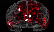 نانوربات‌ها با موفقیت خونریزی مغز را متوقف کردند