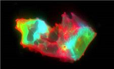 کشف ساختارهای عجیب و غریب در خون افراد مبتلا به کووید طولانی‌مدت