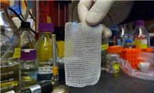 «پرده آمنیوتیک» نماد پیشرفت در درمان بیماری‌های صعب‌العلاج