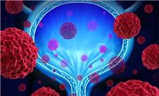 نقش مواد پروبیوتیک در عفونت‌های ادراری زنان