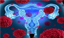 فیبروم رحمی با خطر بیماری قلبی در زنان مرتبط است