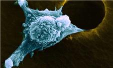 نانوذراتی که سرطان را غافلگیر کردند؛ بیدارباش سیستم ایمنی علیه ملانوما