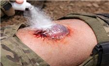 پودری که یک ثانیه ای خونریزی را بند می‌آورد