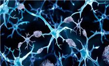 چرا مبتلایان به سرطان از آلزایمر مصون‌اند؟