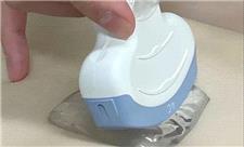 تجربه خوشایندتر سونوگرافی با یک پد ژل نوآورانه