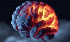 یک بیماری خاموش مغزی خطر زوال عقل را 4 برابر می‌کند