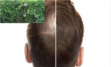 این گیاه می‌تواند کلید رشد مجدد مو باشد