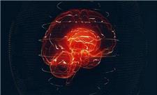 هوش مصنوعی دستیار جدید متخصصان مغز و اعصاب