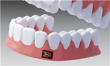 چسبی که التهاب در دهان را ردیابی می‌کند