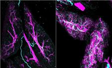 اعصاب، همدست پنهان سرطان لوزالمعده
