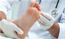 ژل نجات‌بخش؛ اکسیژن‌رسانی به زخم‌های التیام‌ناپذیر برای جلوگیری از قطع عضو