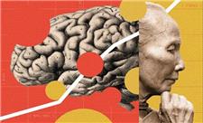 چین در خط مقدم نبرد با آلزایمر