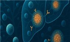 اثربخشی حرکت ورزشی خاص بر روی متابولیسم بیماری‌های کبد