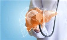 سلول درمانی ریسک مرگ بیماران کبدی را کاهش داد