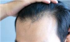 عارضه جانبی نگران‌کننده داروهای لاغری که هیچ‌کس در مورد آن صحبت نمی‌کند