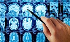 افزایش امنیت هوش مصنوعی در تحلیل MRI مغز با راه حل پژوهشگران دانشگاهی