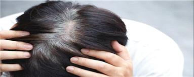 نشانه احتمالی ابتلا به پارکینسون در موها پنهان است