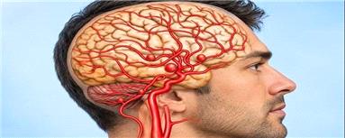 AI و افزایش 40 درصدی موفقیت رادیولوژیست‌ها در شناسایی «ضایعات عروقی مغز»