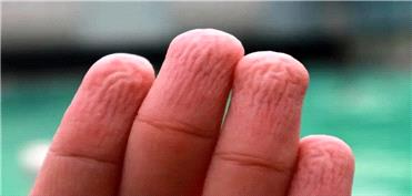 دلیل اینکه انگشتان ما در آب چروک می‌شوند، چیست؟