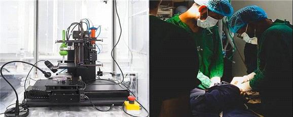 کوچک‌ترین چاپگر زیستی 3 بُعدی جهان، ناجی تارهای صوتی می‌شود