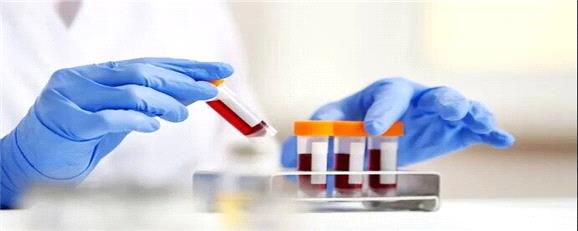 غربالگری کلسترول کودکان ضروری است؟