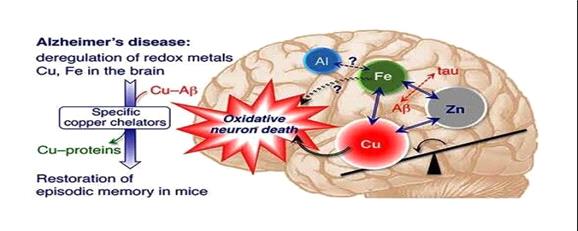 تشدید آلزایمر و نقش بازدارنده ترکیبات معطر گیاهی در مقابله با آن
