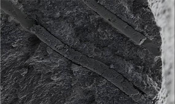 درمان حساسیت دندان با استقرار ربات‌ها در دهان!