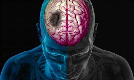 ترکیبات طبیعی، امید تازه در کاهش آسیب‌های سکته مغزی