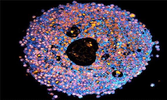 چاپ سه‌بُعدی جفت‌های کوچک جنینی در خدمت سلامت مادران