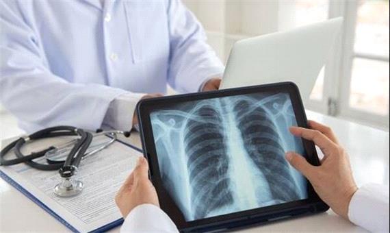 داروی حیاتی بیماران فیبروز ریوی تولید انبوه شد؛افزایش طول عمر تا 11سال