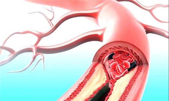 دارویی که همزمان با بیماری قلبی و دیابت مقابله می‌کند