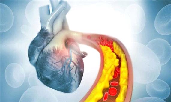 کاهش چربی خون با کمک ویرایش ژن برای اولین بار