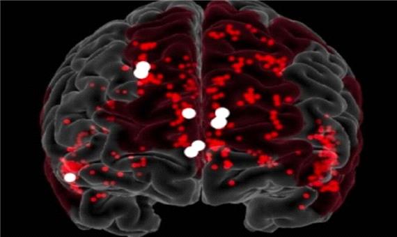 نانوربات‌ها با موفقیت خونریزی مغز را متوقف کردند