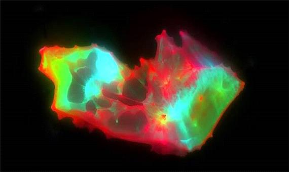 کشف ساختارهای عجیب و غریب در خون افراد مبتلا به کووید طولانی‌مدت