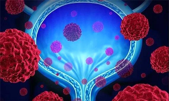 نقش مواد پروبیوتیک در عفونت‌های ادراری زنان