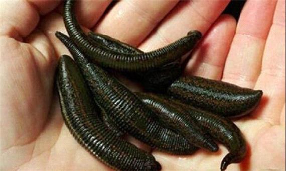 مقابله با بیماری پسوریازیس به کمک «زالو درمانی»